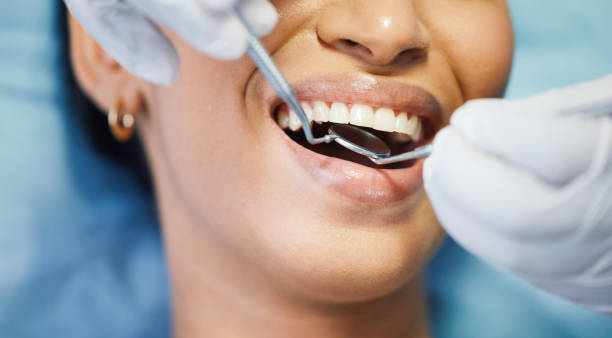 Best Dental Abscess Treatment in Maryvle, IL