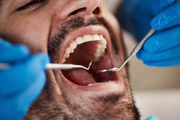 Best 24-Hour Emergency Dental Care in Maryvle, IL