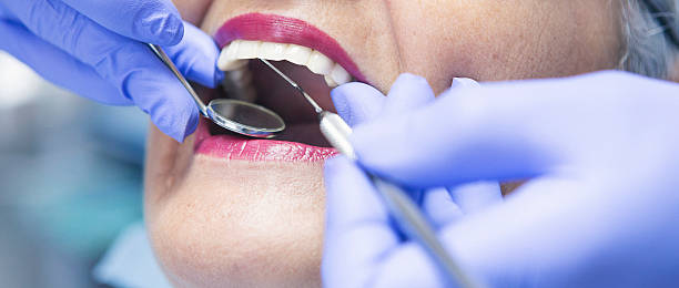 Best Emergency Denture Repair in Maryvle, IL